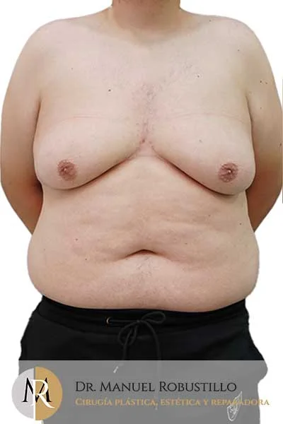 Antes