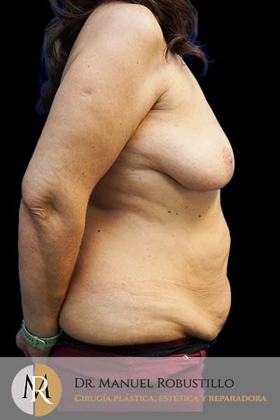 Antes